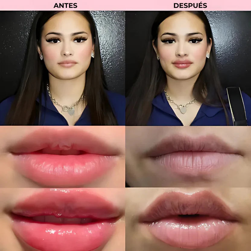 ONALYA™ Roller Lips Boost